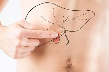 best hospital for gall stones surgery in Katihar, best doctor for gall stones treatment in Katihar, cost of gall bladder surgery in Katihar